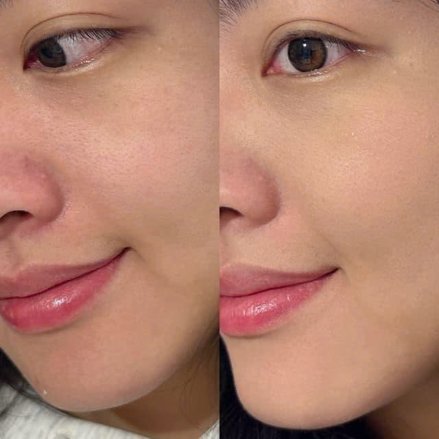 Phấn Phủ Kháng Nước làm mờ lông chân, giảm bóng sáng và tạo lớp nền đẹp tự nhiên.
